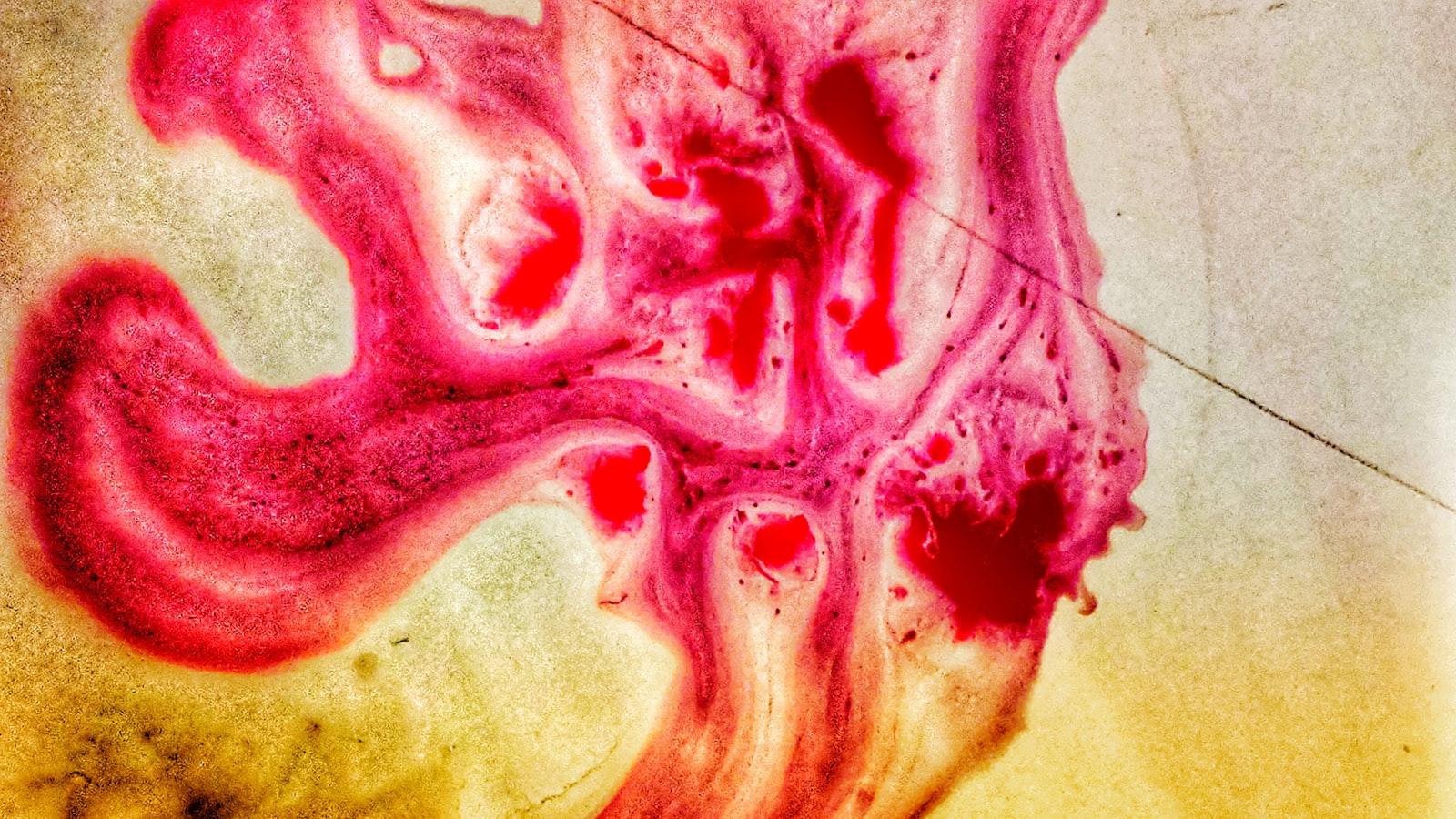 Lifestyle ​Modifications to Lower Cardiovascular ‍Risk